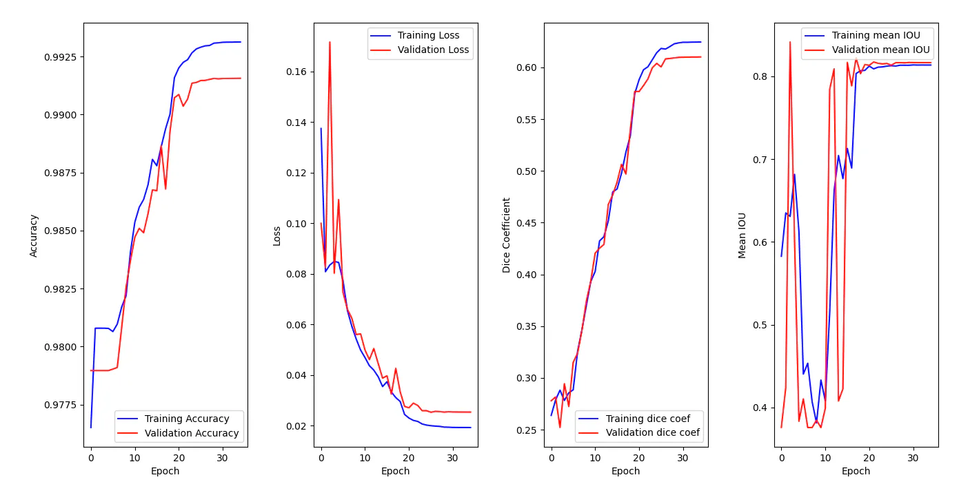 Training metrics of a segmentation model for the BraTS2020 dataset