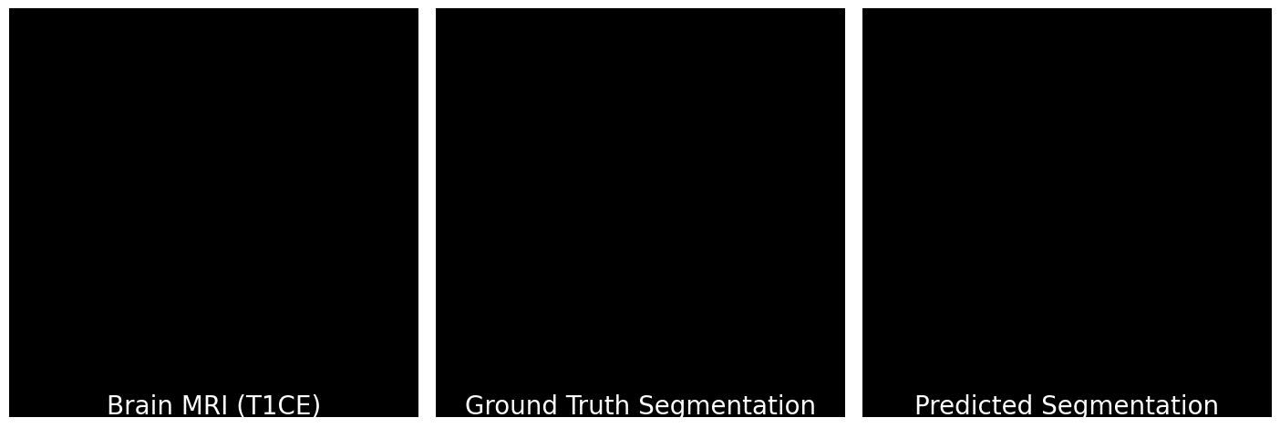Image segmentation: Train a U-Net model to segment brain tumors