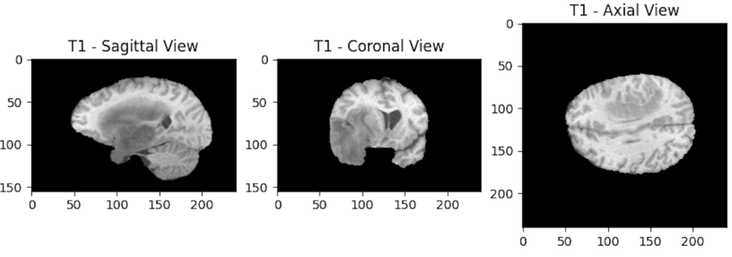 MRI scan viewed in the 3 planes of the human body