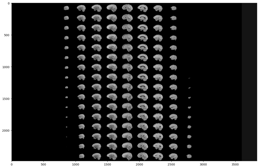 all the slices of a BraTS2020 MRI modality