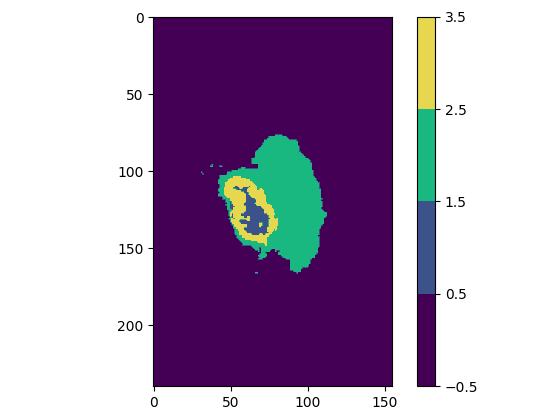 segmentation classes from BraTS2020 dataset