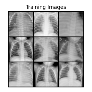 chest-x-ray-pneumonia-dataset-images